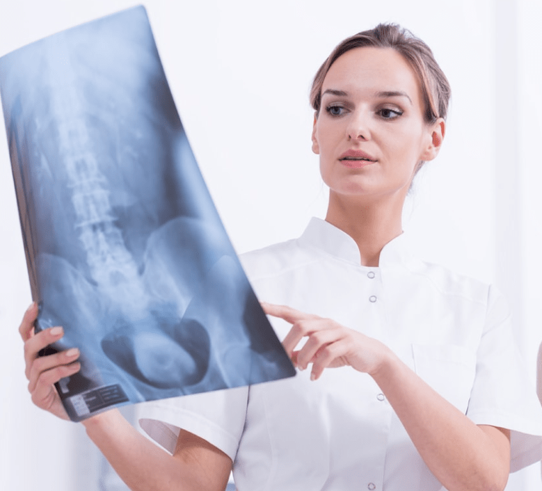 Diagnóstico de osteocondrose torácica por exame de raios-X