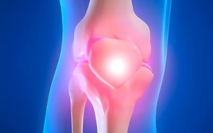 causas de artrose da articulação do joelho